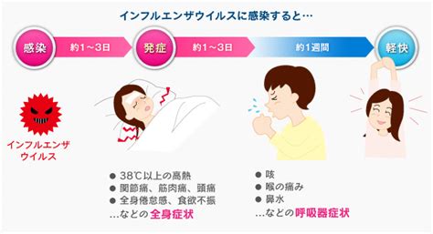 インフルエンザの症状～症状、かぜとの違い～｜インフル・ニュース