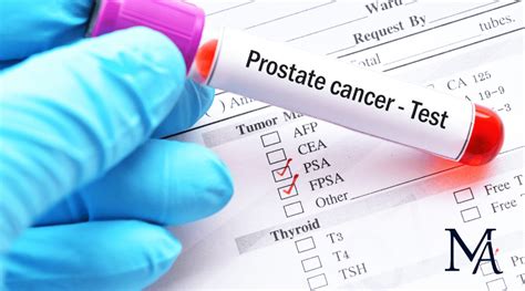 La Surveillance Active Du Cancer De La Prostate