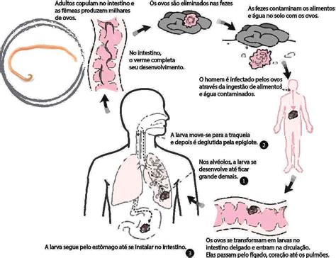 Ascarid Ase O Que Ciclo Transmiss O Sintomas Preven O Tratamento