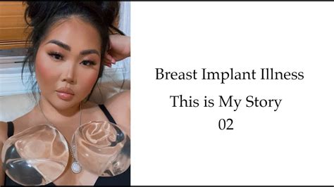 Breast Implant Illness This Is My Story Youtube