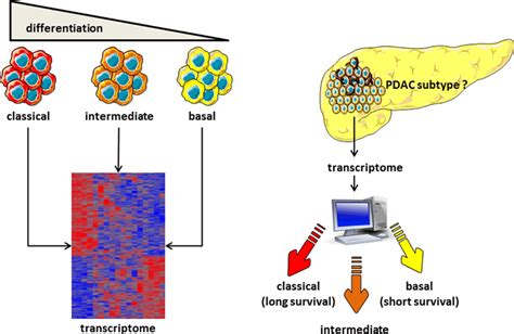 Heterogeneity Of Pdac Transcriptomic Analysis Is Able To Classify Pdac Download Scientific