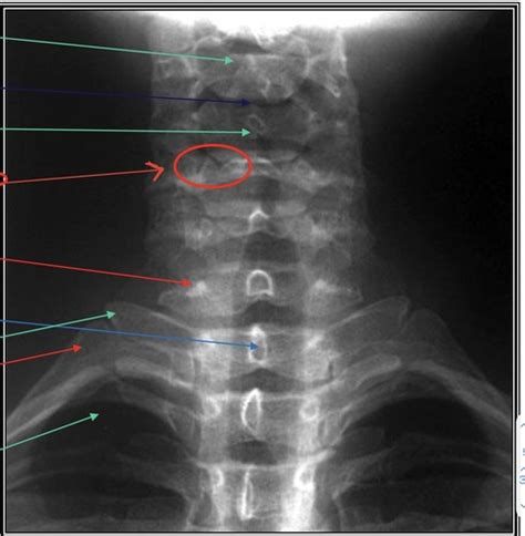 Radiograph Anatomy Flashcards Quizlet