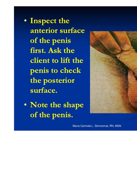 Assessment Of The Male Genitalia