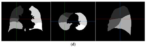 Sensors Free Full Text A Fissure Aided Registration Approach For Automatic Pulmonary Lobe