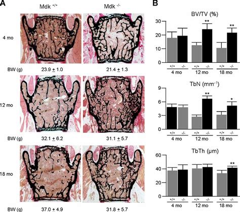 Increased Trabecular Bone Formation In Mice Lacking The Growth Factor