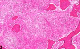 Bone - Callus - Nonneoplastic Lesion Atlas