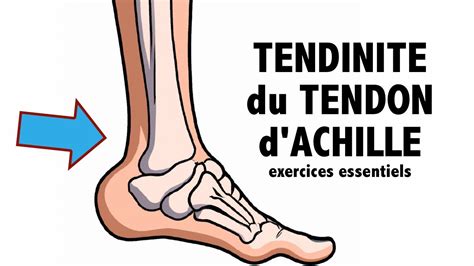 Tendinite Du Tendon D Achille Des Exercices Essentiels Niv