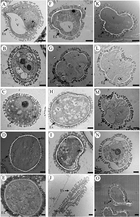 Transmission Electron Micrographs Of Microspores From The Wild Type And