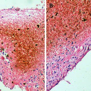 Microscopic examination with haematoxylin and eosin staining was ...