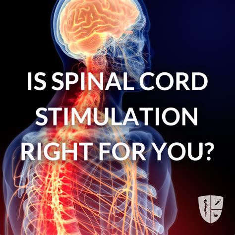 Spinal Cord Stimulation - Alabama Pain Physicians