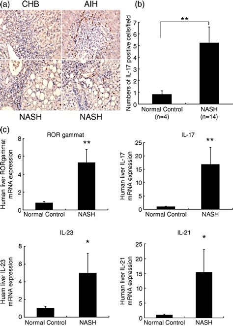 Interleukin IL 17 And Other T Helper Type 17 Th17 Related Cytokine