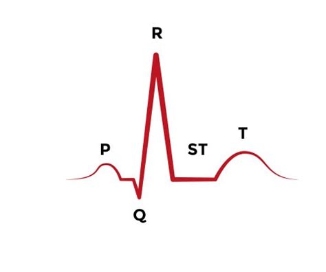 ACLS Rhythm Strips Training and Interpretation