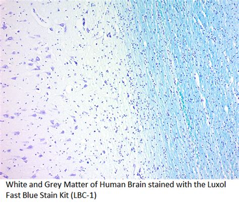 Luxol Fast Blue Histology Stain Kit