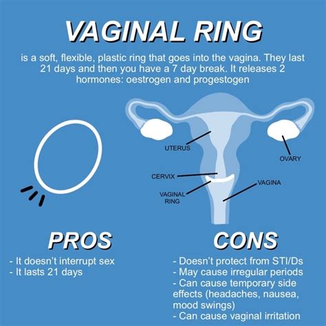 Share More Than 82 Contraceptive Ring Pros And Cons Best Vn