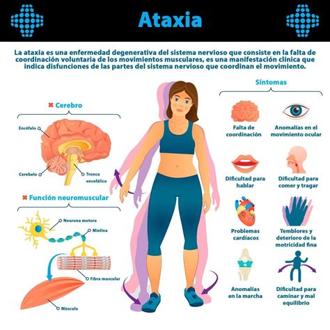 Qu Es La Ataxia Ejercicio Fisico Y Salud Fisioterapia Y