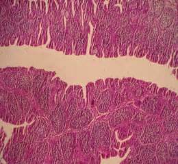 Bursa Fabricius after 2 weeks of exposure to AFB1(a), nonlymphoid cells... | Download Scientific ...