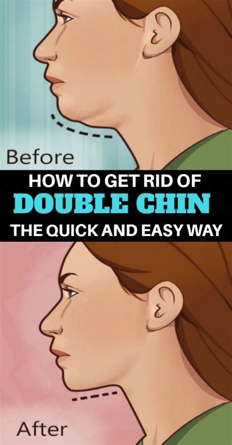 Exercises To Avoid Stubborn Double Chin Double Chin Jaw Exercises