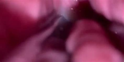 First Time Hairy Virgin Pussy Filled With Cum In Close Up K Tnaflix