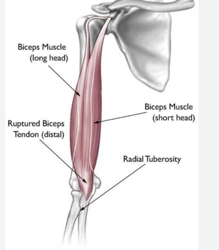 General Anatomy Muscles Of Arm Anterior Posterior Compartment