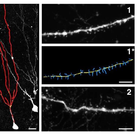 Novel Rabies Virus Variant For Anterograde Tracing Of Neuronal