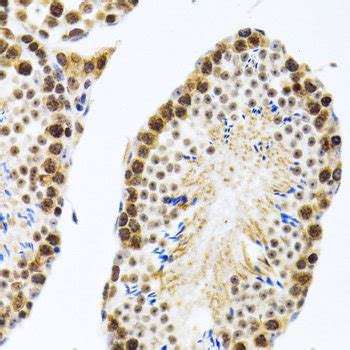 High Affinity And Specificity KO Validated CIRBP Polyclonal Antibody