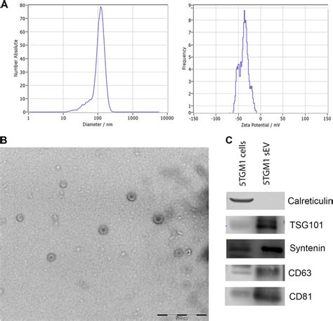 Characterization of extracellular vesicles a Nanoparticle tracking... | Download Scientific Diagram