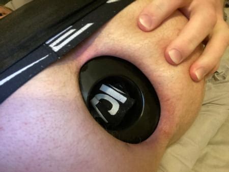 Xxl Meo Anal Stretching Ring Pics Xhamster