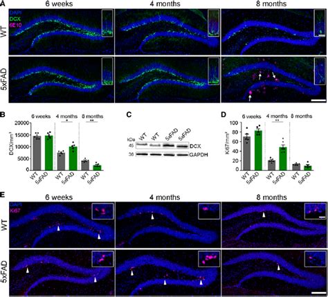 Characterization Of Adult Neurogenesis In The Hippocampus Of Xfad