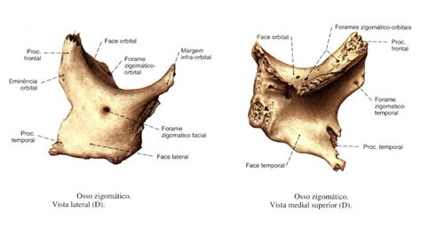 Osso zigomático Anatomia papel e caneta