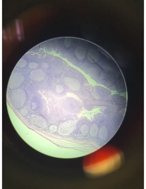 Palatine tonsil Diagram | Quizlet