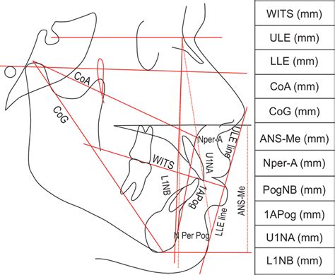 Lateral cephalometric tracing with linear measurements | Download Scientific Diagram