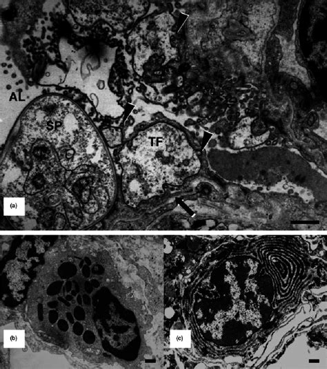 Pneumocystis Oryctolagi Sp Nov Fungus Morphology And Associated Host Download Scientific