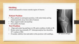 Knee Joint Radiographic Projection S Ppt