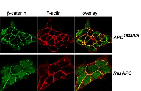 Apc And Oncogenic Kras Are Synergistic In Enhancing Wnt Signaling In