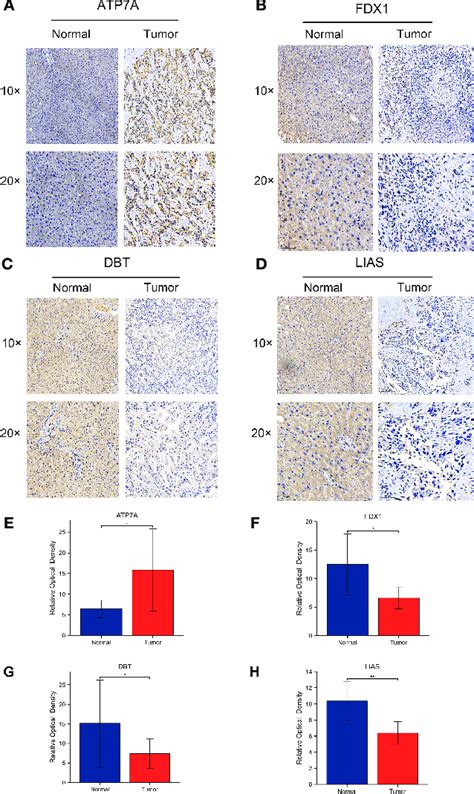 Protein Expression Levels Of 4 CRGs Using Immunohistochemistry A D