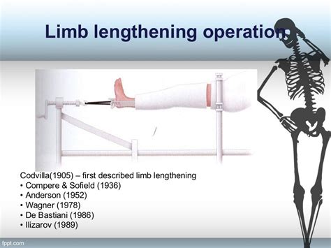 Limb Length Discrepency