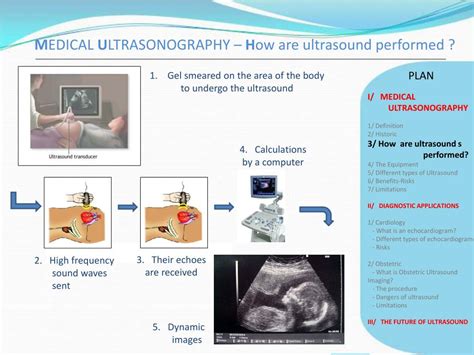 Ppt Medical Ultrasonography Powerpoint Presentation Free Download