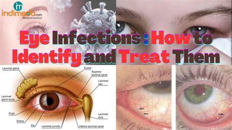 Conjunctivitis In Children: Identifying And Treating The Common Eye ...