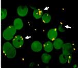 Mycoplasma Wenyonii Mw On And Between The Erythrocyte With High