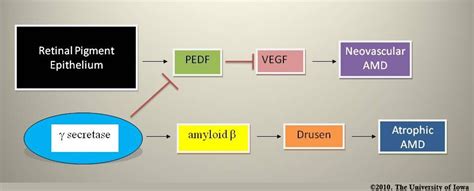 Age Related Macular Degeneration Progression From Atrophic To