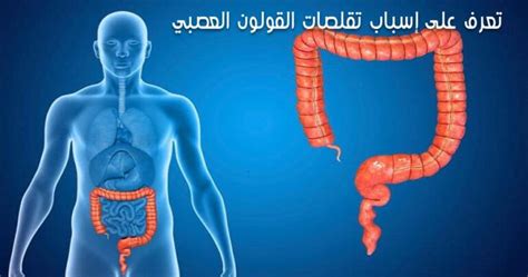 تشنجات القولون Colon Spasm الأعراض والأسباب والعلاج وتغير نمط حياتك