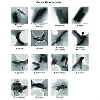 | Representative cryo-TEM images of the cells of slow-growing species ...