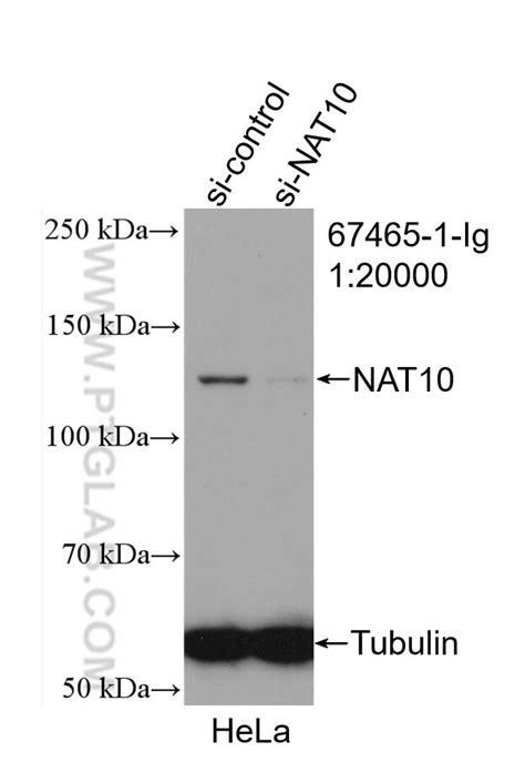 NAT10 antibody 67465 1 Ig Proteintech 武汉三鹰生物技术有限公司