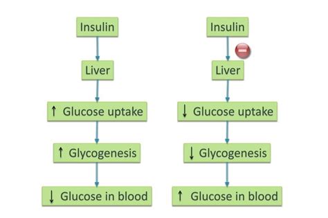 Diabetes Mellitus | Classification , Etiology , Pathogenesis , Complications