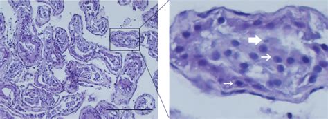 Histological Analysis The Typical Hematoxylin And Eosin Hande Staining