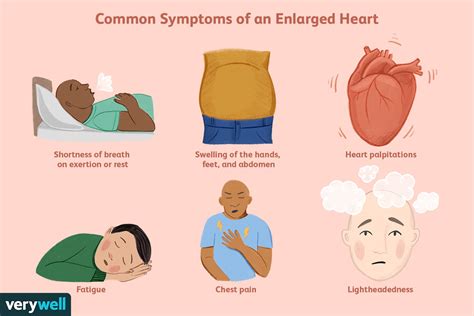 Reasons For An Enlarged Heart