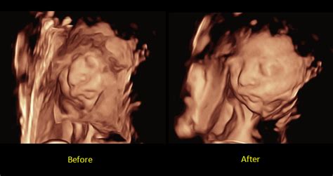 What Is Zone Intelligence Of Resona Tecnomedical Medical