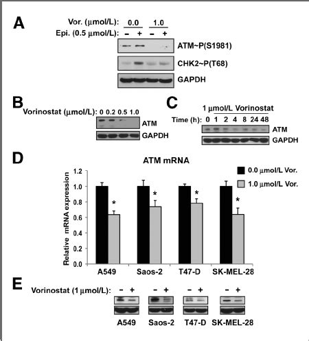 Hdac Inhibitors Attenuate Atm Pathway Activation A Cells Pretreated