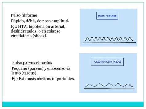 Frecuencia Cardiaca Ppt