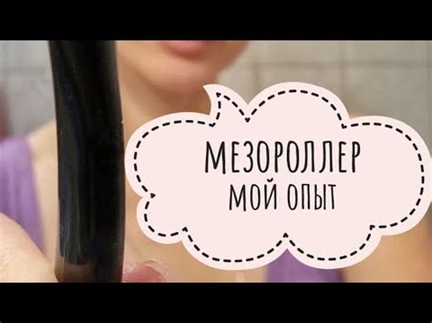 Мезороллер. Мой опыт, плюсы работы с ним и основные рекомендации - YouTube